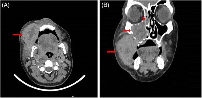 https://cdn.ncbi.nlm.nih.gov/pmc/blobs/3381/9875683/80fc7127ddf3/CNR2-6-e1751-g001.jpg