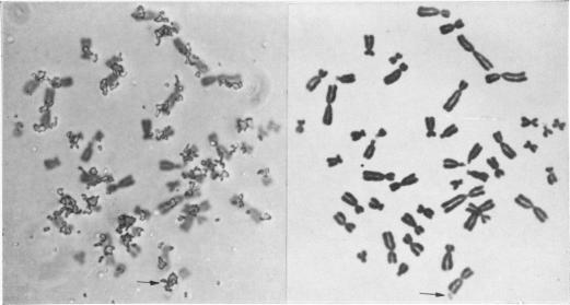 https://cdn.ncbi.nlm.nih.gov/pmc/blobs/3384/1706424/dcc9b165b323/ajhg00381-0012-a.jpg