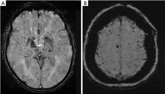 https://cdn.ncbi.nlm.nih.gov/pmc/blobs/3384/7607077/308c33608ee5/atm-08-19-1277-f3.jpg