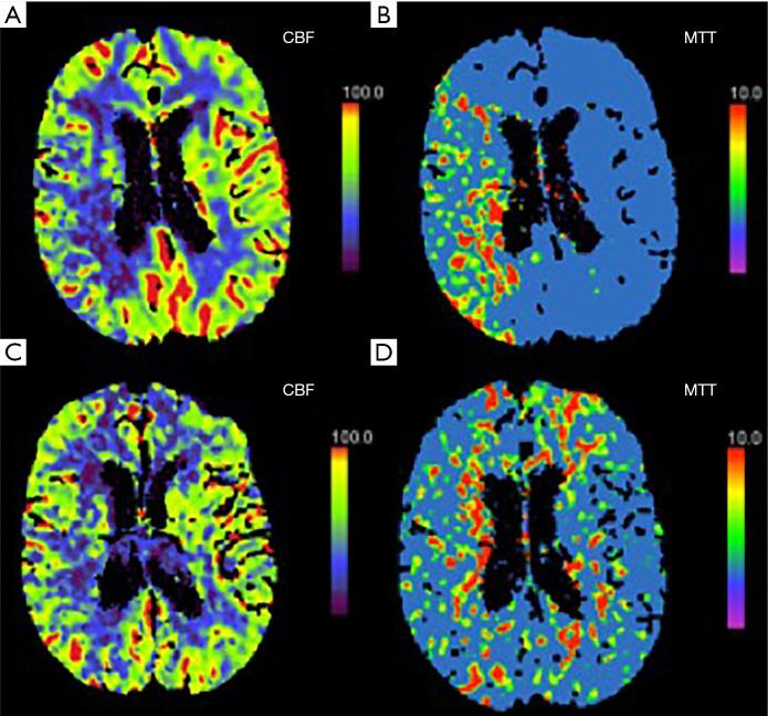 https://cdn.ncbi.nlm.nih.gov/pmc/blobs/3384/7607077/36fcba1d9f4e/atm-08-19-1277-f1.jpg