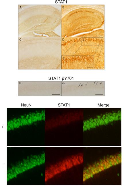 https://cdn.ncbi.nlm.nih.gov/pmc/blobs/3386/3488571/5973218d8035/1742-2094-9-208-5.jpg