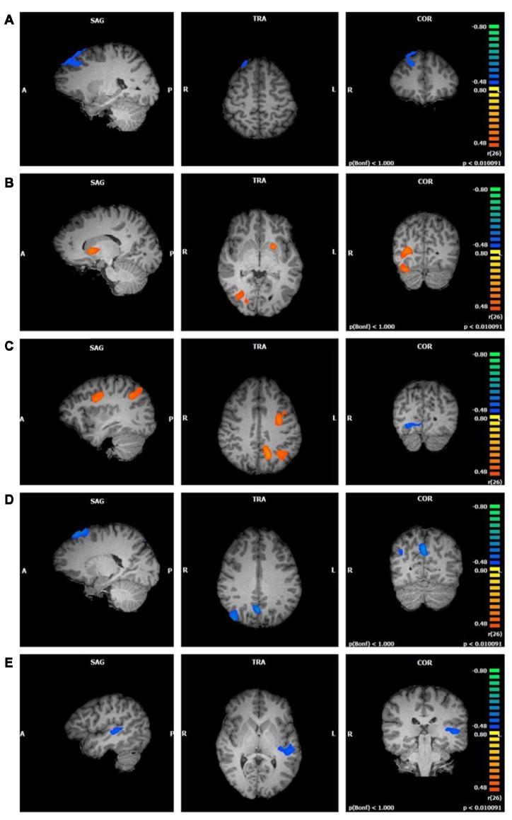 https://cdn.ncbi.nlm.nih.gov/pmc/blobs/3386/6473082/2a85e439bc1b/fnhum-13-00112-g0003.jpg