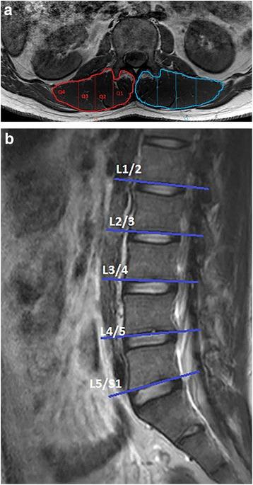 https://cdn.ncbi.nlm.nih.gov/pmc/blobs/338e/4882844/6b298b833395/12891_2016_1090_Fig1_HTML.jpg