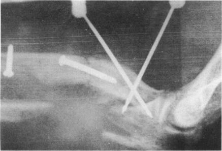 https://cdn.ncbi.nlm.nih.gov/pmc/blobs/338f/1807839/1a11a734a501/bullnyacadmed00025-0058-a.jpg