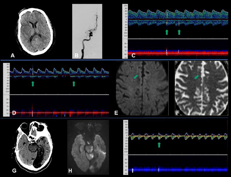 https://cdn.ncbi.nlm.nih.gov/pmc/blobs/3391/7837312/ee5019cdf43d/gr1_lrg.jpg
