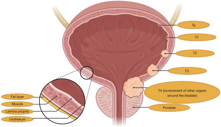 https://cdn.ncbi.nlm.nih.gov/pmc/blobs/3394/8039595/7b434245f7f1/tau-10-03-1541-f1.jpg
