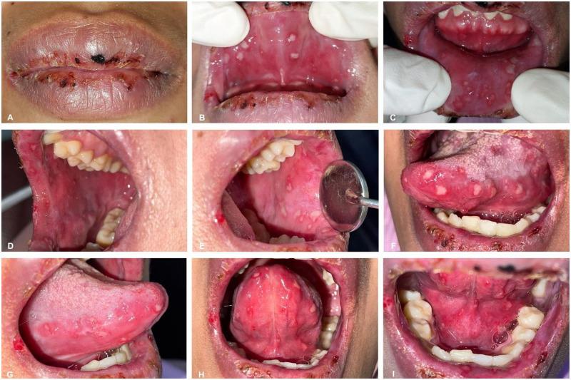 https://cdn.ncbi.nlm.nih.gov/pmc/blobs/3398/11144004/aa1e1d4bf260/IMCRJ-17-535-g0001.jpg