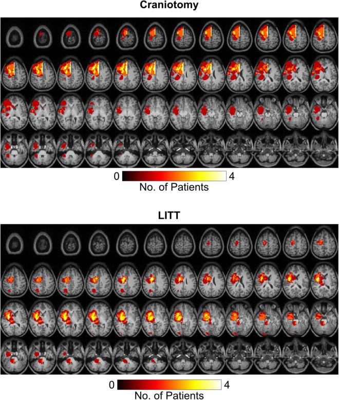 https://cdn.ncbi.nlm.nih.gov/pmc/blobs/339b/8585791/73da6f1cb291/fnins-15-665016-g002.jpg