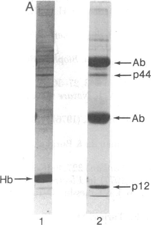 https://cdn.ncbi.nlm.nih.gov/pmc/blobs/33a9/393105/29f495d0bf9b/pnas00022-0269-c.jpg