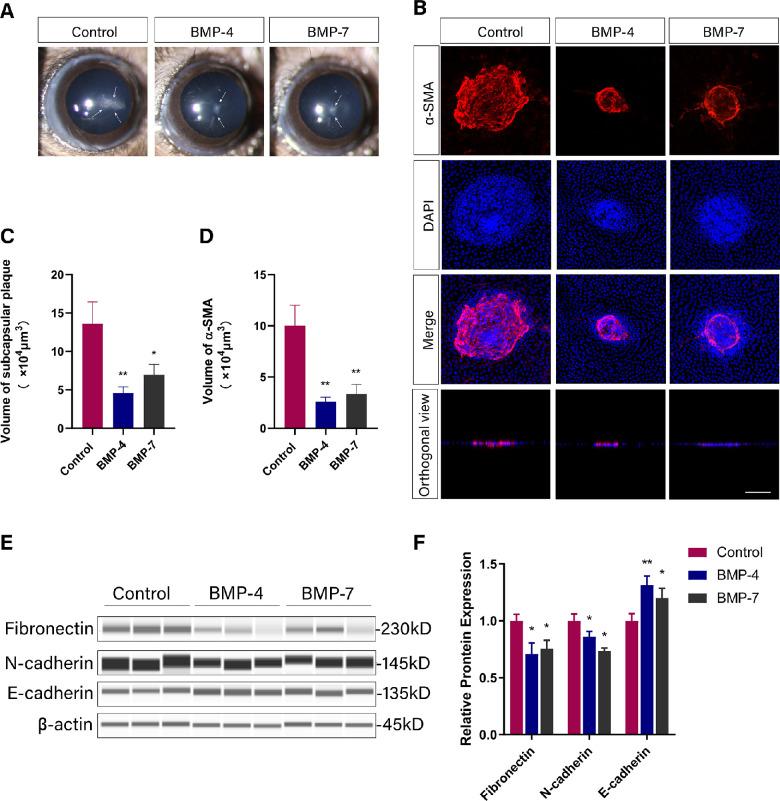 https://cdn.ncbi.nlm.nih.gov/pmc/blobs/33ad/10103728/fb242f79436a/iovs-64-4-12-f001.jpg