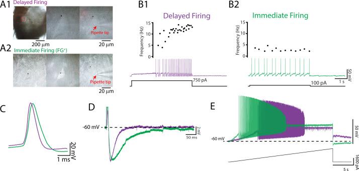 https://cdn.ncbi.nlm.nih.gov/pmc/blobs/33b0/8641952/2a35adef2d32/elife-71385-fig1.jpg