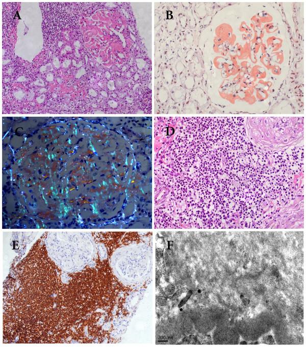 https://cdn.ncbi.nlm.nih.gov/pmc/blobs/33b1/3206418/7d1f741641fe/1746-1596-6-99-4.jpg