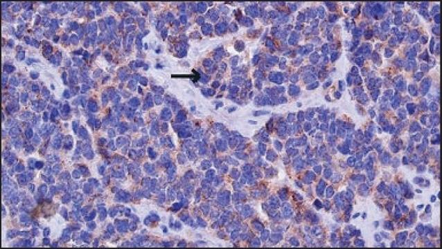 https://cdn.ncbi.nlm.nih.gov/pmc/blobs/33b5/2841464/dee1af8f2692/ASM-29-320-g003.jpg