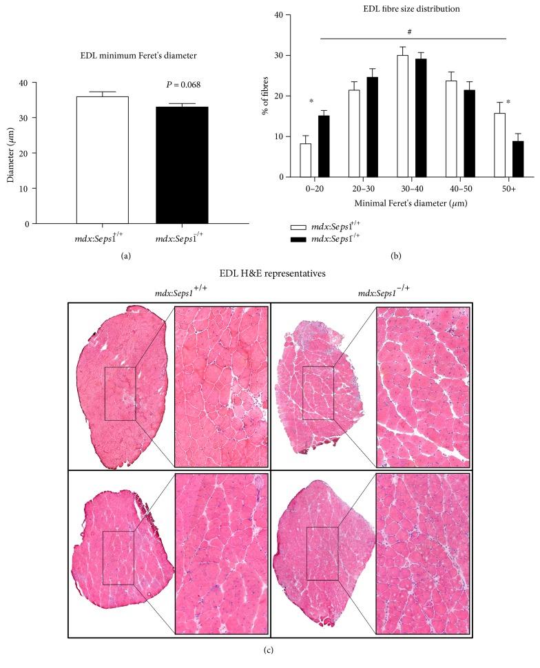 https://cdn.ncbi.nlm.nih.gov/pmc/blobs/33b8/5448157/29817ebde27e/MI2017-7043429.006.jpg