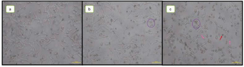 https://cdn.ncbi.nlm.nih.gov/pmc/blobs/33bc/11167271/c9ce81734eec/gr20.jpg