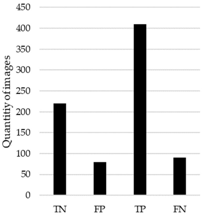 https://cdn.ncbi.nlm.nih.gov/pmc/blobs/33c2/11311263/15e87e787616/diagnostics-14-01691-g010.jpg