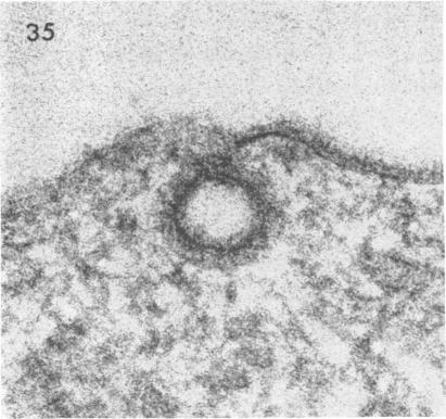 https://cdn.ncbi.nlm.nih.gov/pmc/blobs/33c7/375714/6d7303c6da48/jvirol00321-0083-f.jpg