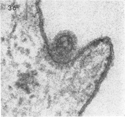 https://cdn.ncbi.nlm.nih.gov/pmc/blobs/33c7/375714/97ed4c14f469/jvirol00321-0083-e.jpg