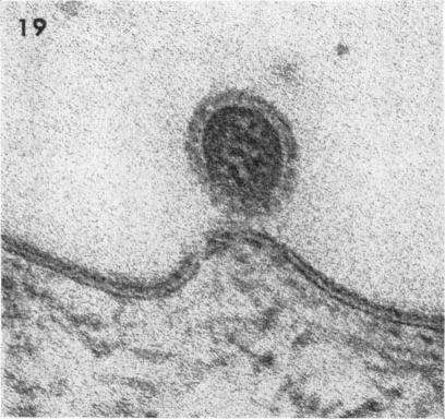 https://cdn.ncbi.nlm.nih.gov/pmc/blobs/33c7/375714/9fb0d0b537cd/jvirol00321-0081-b.jpg