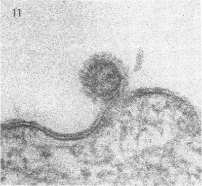 https://cdn.ncbi.nlm.nih.gov/pmc/blobs/33c7/375714/de2c8bcb6a5f/jvirol00321-0078-f.jpg