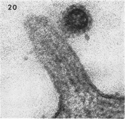 https://cdn.ncbi.nlm.nih.gov/pmc/blobs/33c7/375714/ec4a765a07e7/jvirol00321-0081-a.jpg
