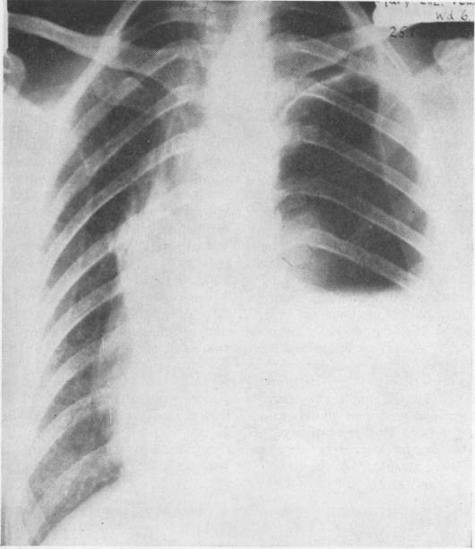 https://cdn.ncbi.nlm.nih.gov/pmc/blobs/33c7/471845/070a1e67fd49/thorax00101-0093-a.jpg