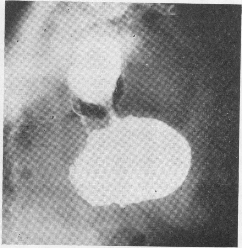 https://cdn.ncbi.nlm.nih.gov/pmc/blobs/33c7/471845/ea790e8e333e/thorax00101-0097-c.jpg
