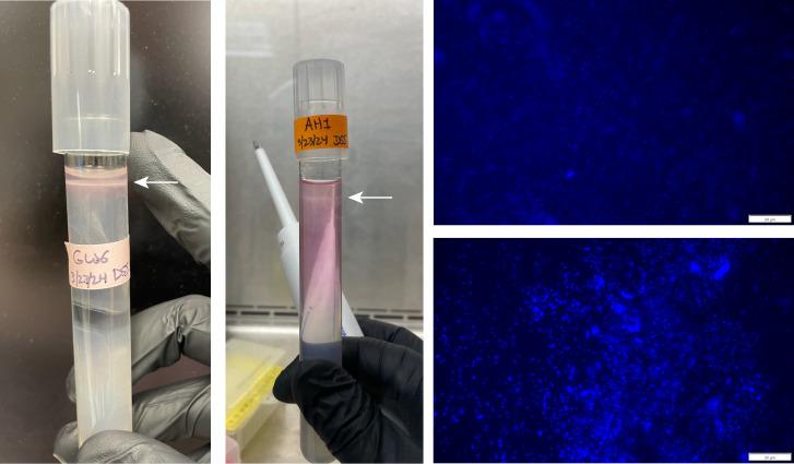 https://cdn.ncbi.nlm.nih.gov/pmc/blobs/33d1/12285272/2fc3087dea39/aem.00216-25.f002.jpg