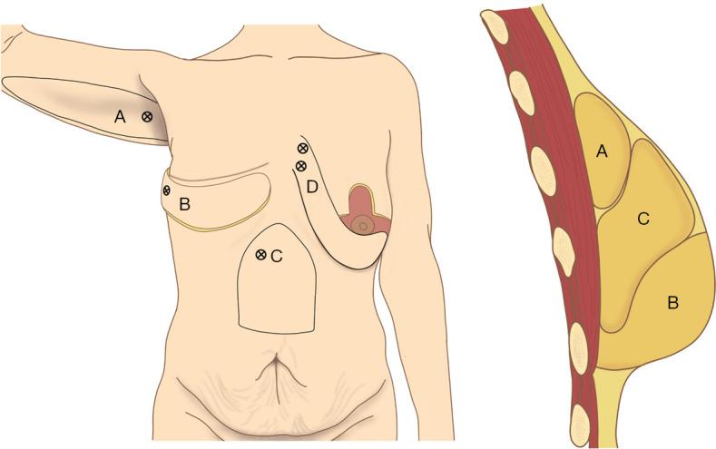 https://cdn.ncbi.nlm.nih.gov/pmc/blobs/33d2/11150200/3c9704e7911e/gs-13-05-760-f12.jpg