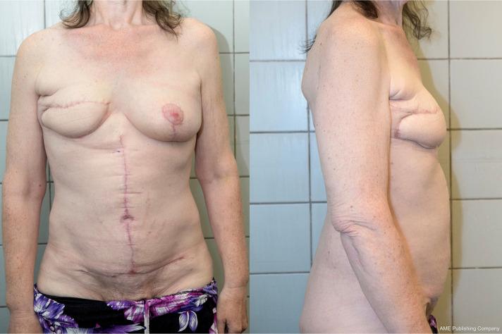 https://cdn.ncbi.nlm.nih.gov/pmc/blobs/33d2/11150200/abce0678fc96/gs-13-05-760-f8.jpg
