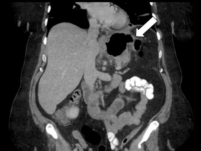 https://cdn.ncbi.nlm.nih.gov/pmc/blobs/33d4/11378216/5193973df7f2/gr3.jpg