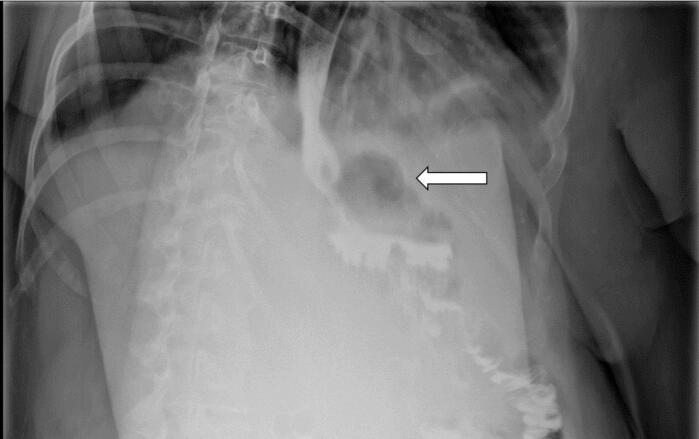 https://cdn.ncbi.nlm.nih.gov/pmc/blobs/33d4/11378216/5ed055fbaa95/gr2.jpg