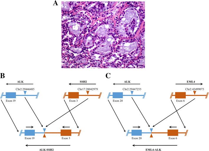 https://cdn.ncbi.nlm.nih.gov/pmc/blobs/33d6/8832643/af925ffe11f6/13000_2022_1212_Fig2_HTML.jpg