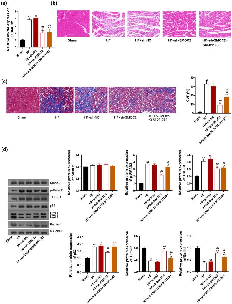 https://cdn.ncbi.nlm.nih.gov/pmc/blobs/33dc/10350896/0fd0c6aba68a/j_med-2023-0752-fig005.jpg