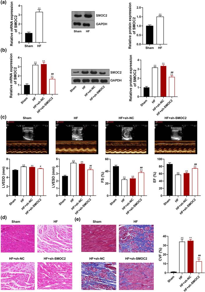 https://cdn.ncbi.nlm.nih.gov/pmc/blobs/33dc/10350896/399d647c85b0/j_med-2023-0752-fig001.jpg