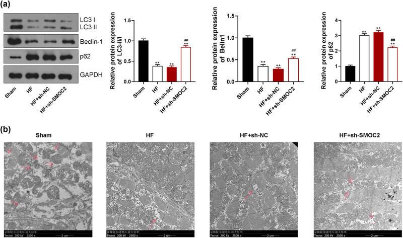 https://cdn.ncbi.nlm.nih.gov/pmc/blobs/33dc/10350896/b68ea21545ae/j_med-2023-0752-fig003.jpg