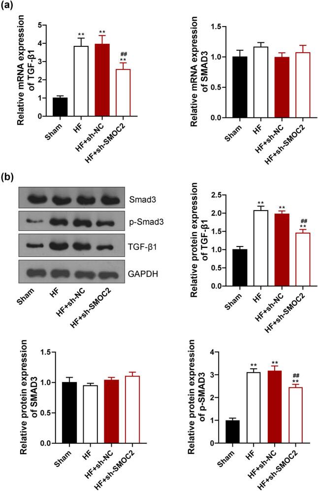https://cdn.ncbi.nlm.nih.gov/pmc/blobs/33dc/10350896/d047c3fb364b/j_med-2023-0752-fig004.jpg