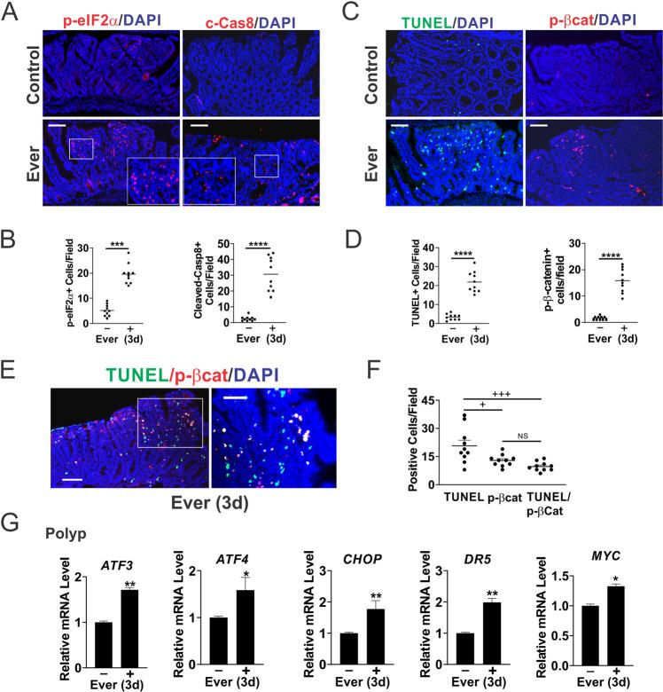 https://cdn.ncbi.nlm.nih.gov/pmc/blobs/33dd/10256613/1e05c9b3a96b/41388_2023_2706_Fig2_HTML.jpg