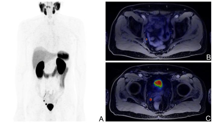 https://cdn.ncbi.nlm.nih.gov/pmc/blobs/33e6/10526235/87bc84934c41/cancers-15-04589-g001.jpg