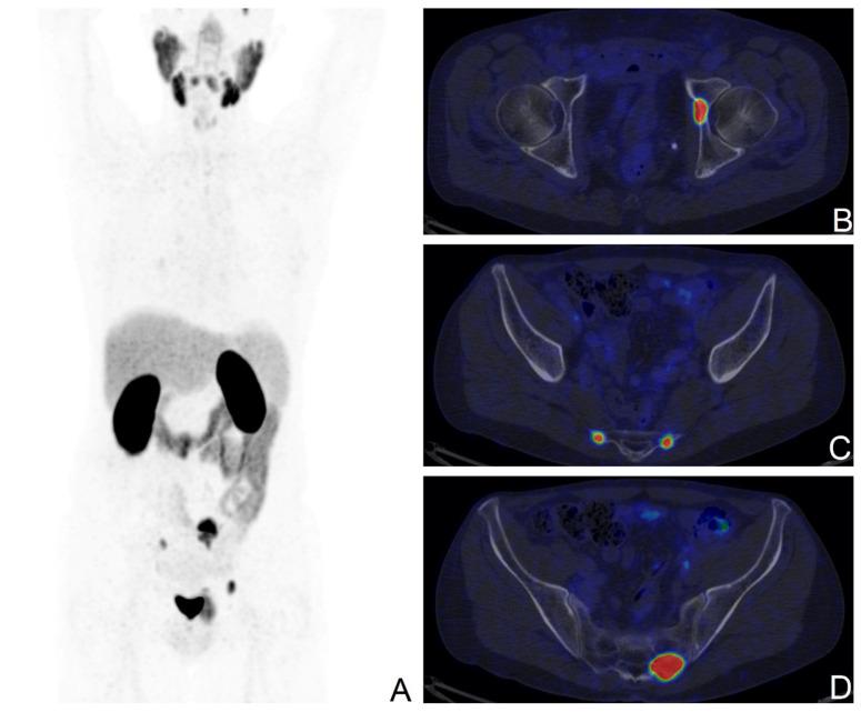 https://cdn.ncbi.nlm.nih.gov/pmc/blobs/33e6/10526235/94c1c14b978c/cancers-15-04589-g002.jpg