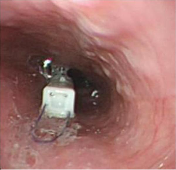 https://cdn.ncbi.nlm.nih.gov/pmc/blobs/33e9/3561268/2d3698bf55a8/1471-230X-13-10-3.jpg
