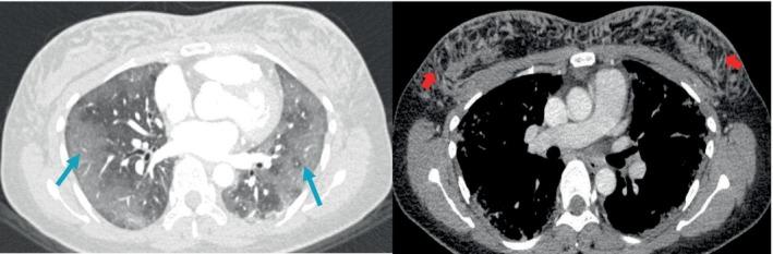https://cdn.ncbi.nlm.nih.gov/pmc/blobs/33f7/12135025/9f9a638af66c/RCR2-13-e70227-g003.jpg
