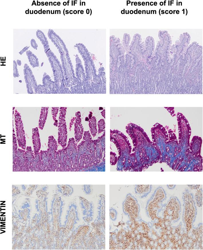 https://cdn.ncbi.nlm.nih.gov/pmc/blobs/3406/10229354/6bd44159d0bc/JVIM-37-936-g002.jpg
