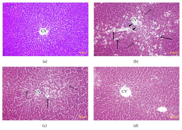 https://cdn.ncbi.nlm.nih.gov/pmc/blobs/340a/4699077/1d312c6d049a/OMCL2016-3935841.005.jpg