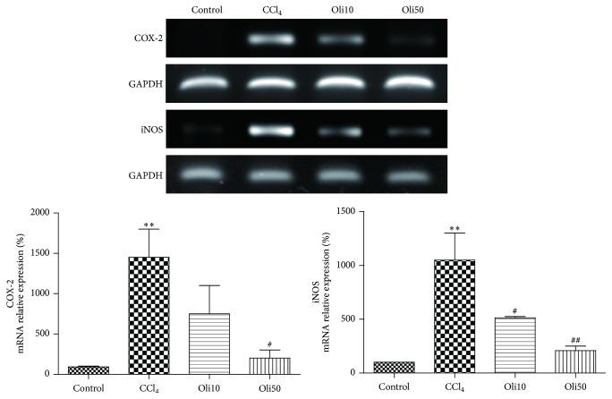 https://cdn.ncbi.nlm.nih.gov/pmc/blobs/340a/4699077/432286fc1b87/OMCL2016-3935841.007.jpg