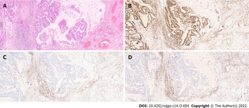 https://cdn.ncbi.nlm.nih.gov/pmc/blobs/340a/8919024/6e786a009834/WJGO-14-654-g002.jpg