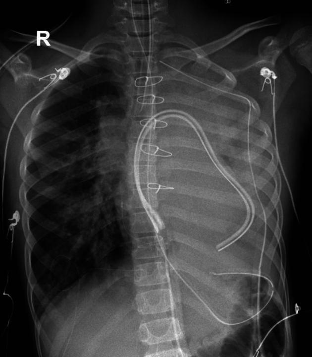 https://cdn.ncbi.nlm.nih.gov/pmc/blobs/340e/11184659/a1adc9f1a4fb/fx2.jpg