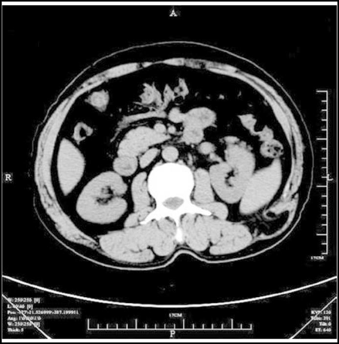 https://cdn.ncbi.nlm.nih.gov/pmc/blobs/341c/3809316/7e4fed9cfc82/pjms-29-874-g002.jpg