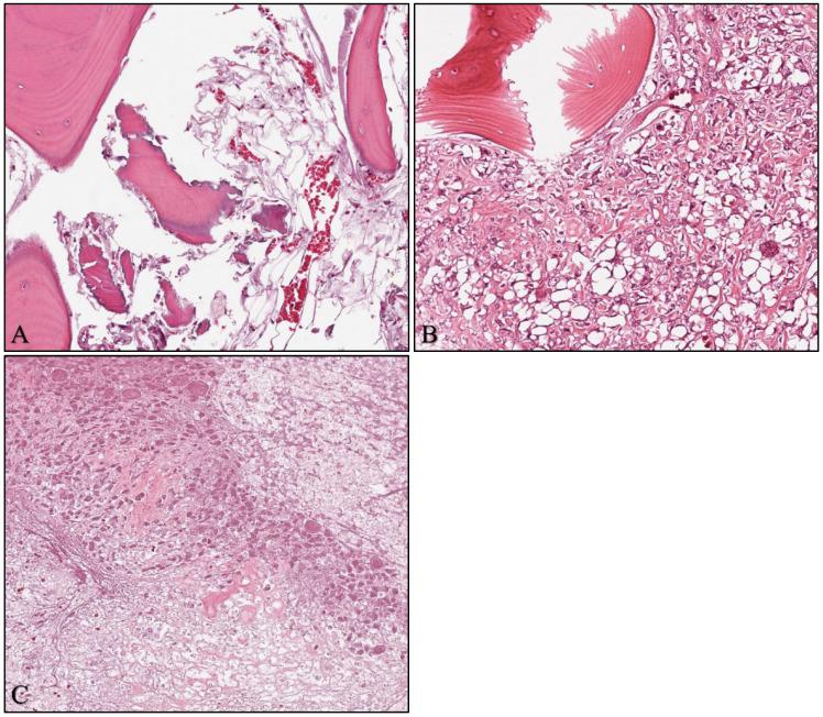 https://cdn.ncbi.nlm.nih.gov/pmc/blobs/341f/10136449/9efca97fcb47/cancers-15-02290-g001.jpg
