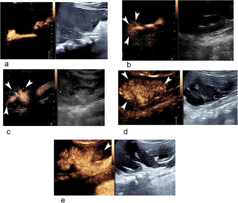 https://cdn.ncbi.nlm.nih.gov/pmc/blobs/3421/11688366/9d7d5889749c/fped-12-1478436-g001.jpg